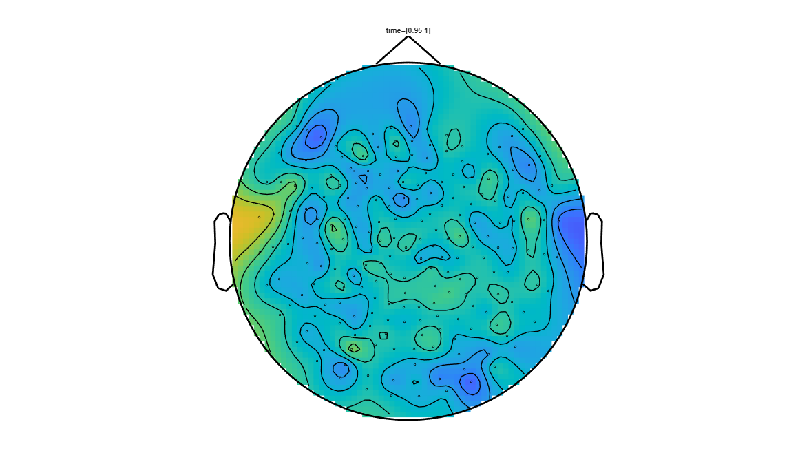 ../../../_images/6-meg-pipeline-gallery_notebooks_fieldtrip_fieldtrip_kit_spatio-temporal-clustering_33_21.png