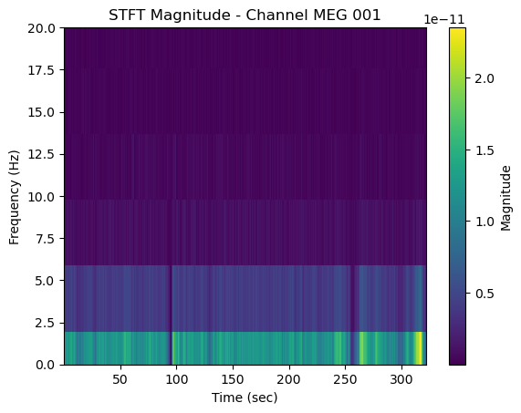 ../../../_images/6-meg-pipeline-gallery_notebooks_mne_mne_kit_resting_state_pipeline_36_0.png